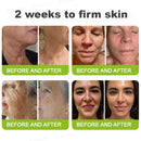 Creme firmador e antirrugas Rolimey® Botox & Vita-A Retinol Shot - Último dia da promoção com 70% de desconto