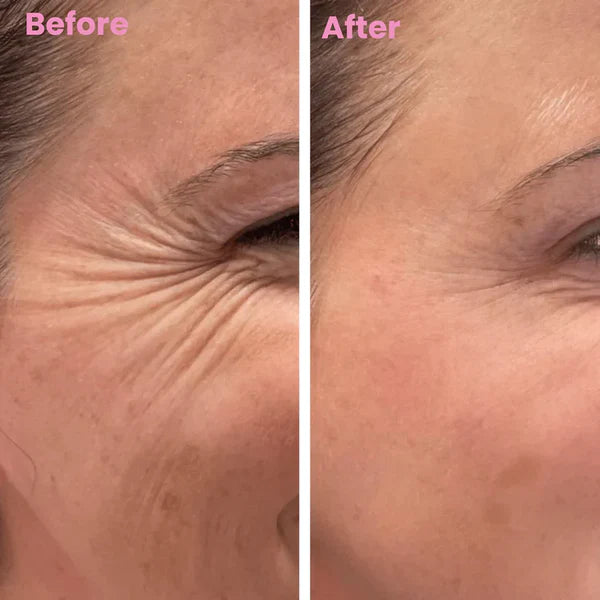 Dermasil Fita Cicatrizante