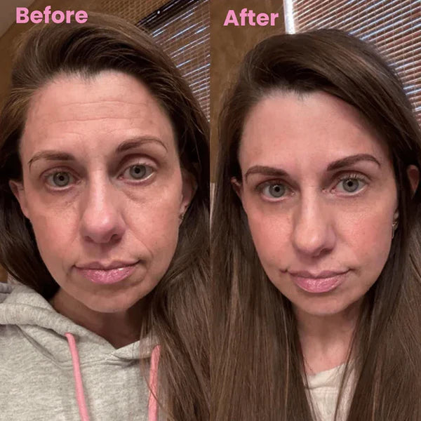 Dermasil Fita Cicatrizante